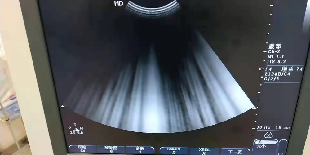 彩超維修